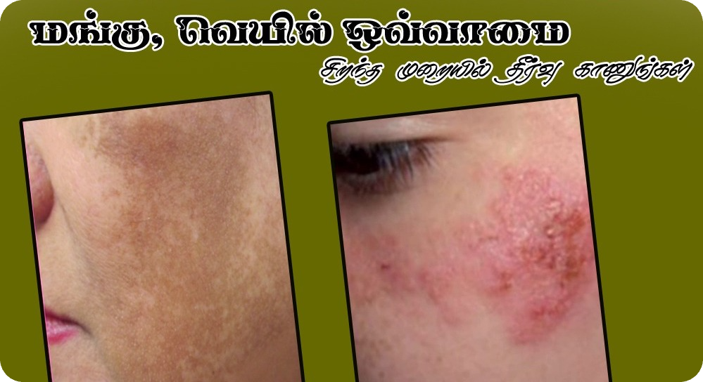 Pigmentation Care